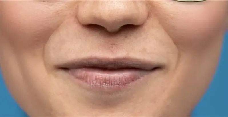 gallery-one-after-img