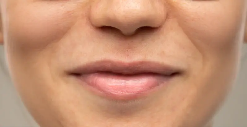 gallery-one-before-img